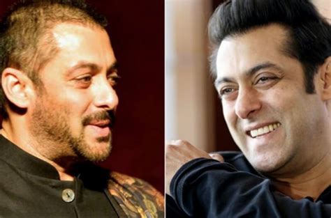 salman khan hair transplant doctor